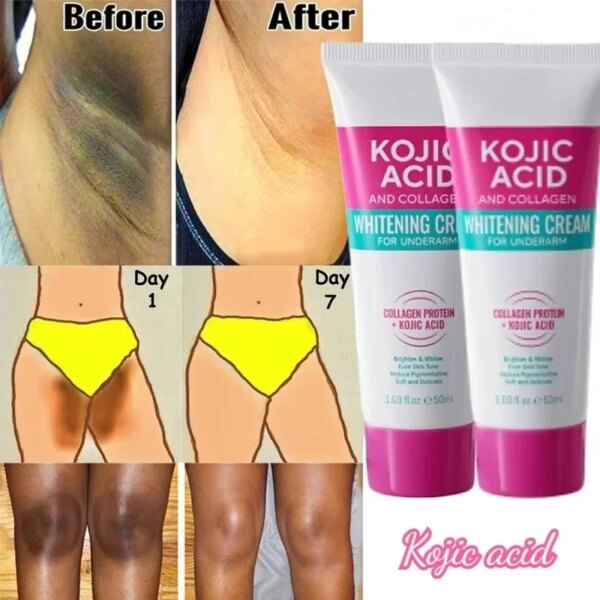 Collagen Underarm Cream Lightening Melanin Moisturizing Kojic Acid Cream Fade Dull Hand Body Elbows Fast Smooth Nourish Lotion